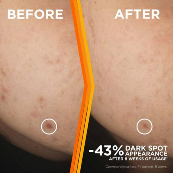 GARNIER SKIN ACTIVE FACE SERUM VITAMIN C غارنييه سكين أكتيف فيس سيروم فيتامين سي